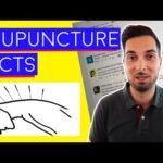 acupuncture