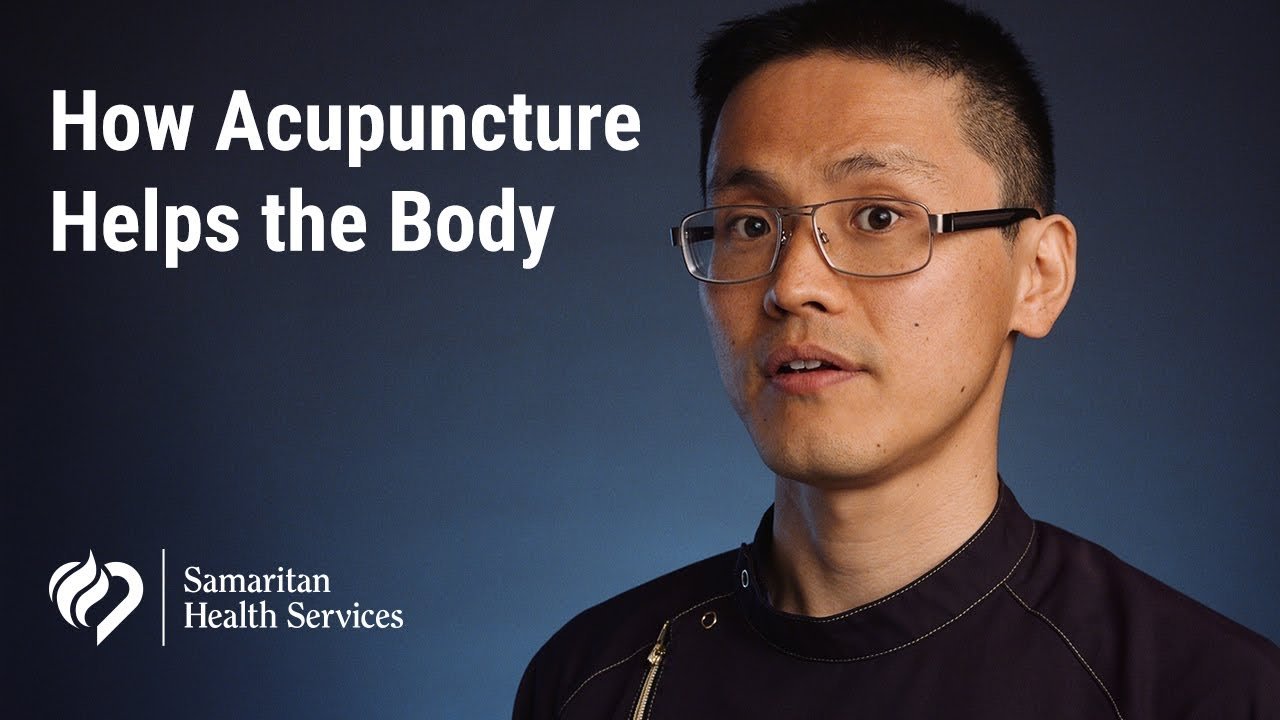 acupuncture