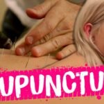 acupuncture