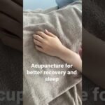 acupuncture