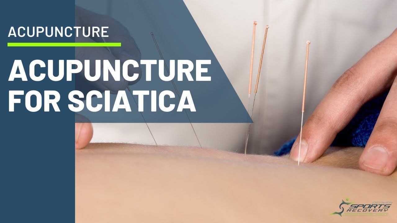 acupuncture