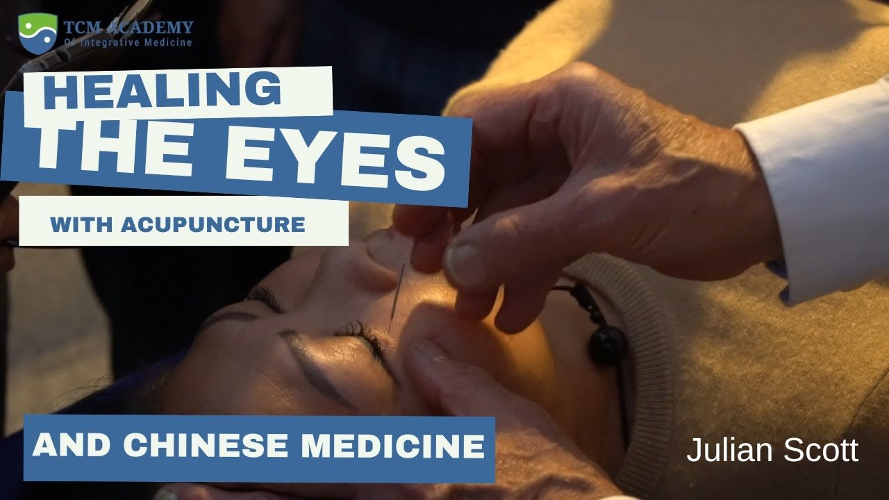 acupuncture