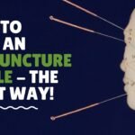 acupuncture