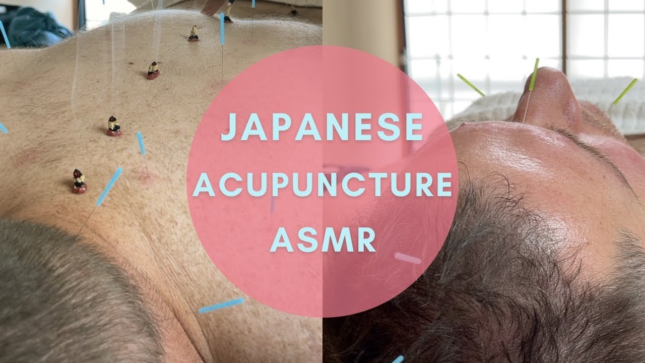 acupuncture