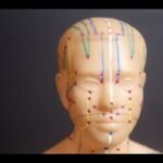 acupuncture