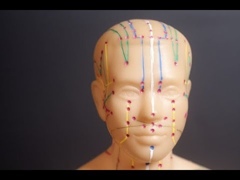 acupuncture