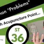 acupuncture